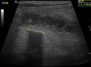 Stomach Foreign Body veterinary ultrasound Oregon